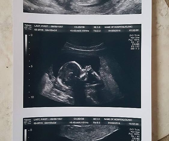 fake ultrasound pictures